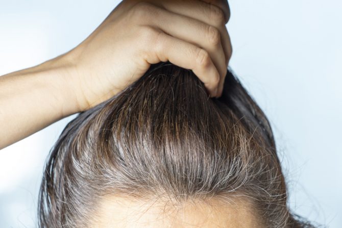 alimentos para prevenir la aparición de canas